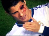 Vidéo Cristiano Ronaldo en sang